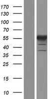 PFKFB2 Human Over-expression Lysates NM_001018053