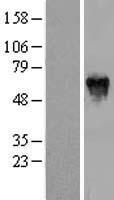 PFKFB2 Human Over-expression Lysates NM_006212