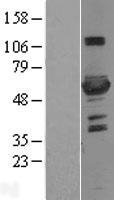 ls005209 pfkfb3 human over expression lysates nm 004566 wb testing 1