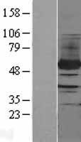 PFKFB4 Human Over-expression Lysates NM_004567