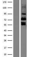 ls005212 vit human over expression lysates nm 001177969 wb testing 1