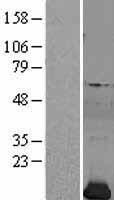ls005217 profilin 2 pfn2 human over expression lysates nm 002628 wb testing 2