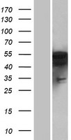PFTK1 (CDK14) Human Over-expression Lysates NM_012395