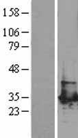 PGAM1 Human Over-expression Lysates NM_002629