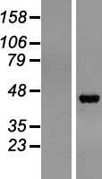 Pepsinogen II (PGC) Human Over-expression Lysates NM_002630