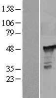 PGD Human Over-expression Lysates NM_002631