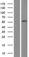 ls005236 pgm1 human over expression lysates nm 001172818 wb testing 1