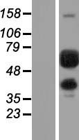 ls005236 pgm1 human over expression lysates nm 002633 wb testing 2