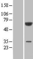 PGM3 Human Over-expression Lysates NM_015599
