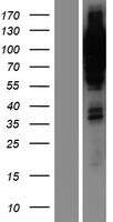 ls005241 progesterone receptor pgr human over expression lysates nm 000926 wb testing 1