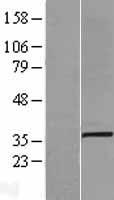 SLC25A3 Human Over-expression Lysates NM_002635