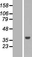 SLC25A3 Human Over-expression Lysates NM_005888