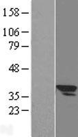 SLC25A3 Human Over-expression Lysates NM_213611