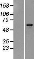 ls005255 phka1 human over expression lysates nm 002637 wb testing 1