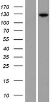 ls005257 phosphorylase b phkb human over expression lysates nm 000293 wb testing 1