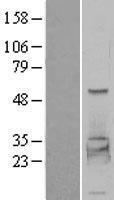 ls005261 phkg2 human over expression lysates nm 000294 wb testing 2