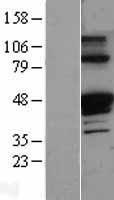 alpha 1 Antitrypsin (SERPINA1) Human Over-expression Lysates NM_000295