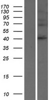 SERPINB8 Human Over-expression Lysates NM_002640