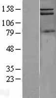 PI 3 Kinase Class 2A (PIK3C2A) Human Over-expression Lysates NM_002645