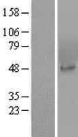 PIP5K2 alpha (PIP4K2A) Human Over-expression Lysates NM_005028