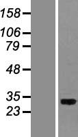 PITPN (PITPNA) Human Over-expression Lysates NM_006224