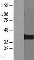 PITX2 Human Over-expression Lysates NM_000325