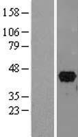PITX2 Human Over-expression Lysates NM_153426