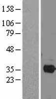 PITX2 Human Over-expression Lysates NM_153427