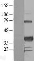PITX3 Human Over-expression Lysates NM_005029