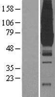 ls005313 pyruvate kinase pklr human over expression lysates nm 000298 wb testing 1