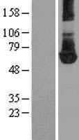 PKM2 (PKM) Human Over-expression Lysates NM_002654