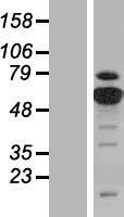 PKM2 (PKM) Human Over-expression Lysates NM_182470
