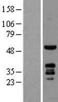 PKNOX1 Human Over-expression Lysates NM_004571