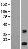 PLA2G1B Human Over-expression Lysates NM_000928