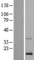 Phospholipase A2 IIA (PLA2G2A) Human Over-expression Lysates NM_000300