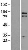 Phospholipase A2 (PLA2G4A) Human Over-expression Lysates NM_024420