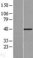 PLAGL1 Human Over-expression Lysates NM_001080955