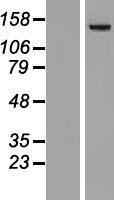 Phospholipase C beta 4 (PLCB4) Human Over-expression Lysates NM_182797