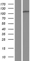 Phospholipase D2 (PLD2) Human Over-expression Lysates NM_002663