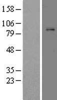 ls005340 plasminogen plg human over expression lysates nm 000301 wb testing 1