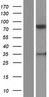 PLOD1 Human Over-expression Lysates NM_000302