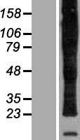 ls005354 plp1 human over expression lysates nm 199478 wb testing 2