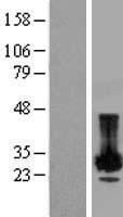 PLP2 Human Over-expression Lysates NM_002668
