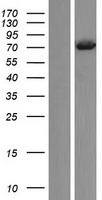ls005358 t plastin pls3 human over expression lysates nm 001172335 wb testing 1