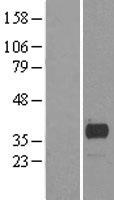 Scramblase 1 (PLSCR1) Human Over-expression Lysates NM_021105