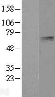 PLTP Human Over-expression Lysates NM_006227