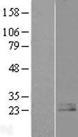 Nociceptin (PNOC) Human Over-expression Lysates NM_006228