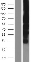 PML Protein (PML) Human Over-expression Lysates NM_033244