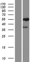 PML Protein (PML) Human Over-expression Lysates NM_033246