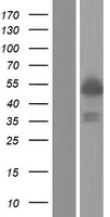 PML Protein (PML) Human Over-expression Lysates NM_033247